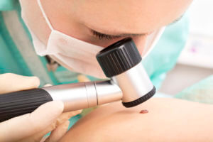 dermatologist checking for skin cancer
