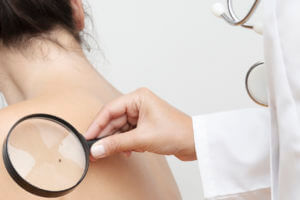 Dermatologist Checking Cancerous spots for skin cancer