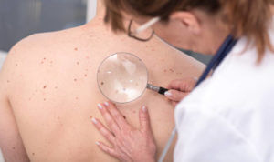 Dermatologist examining the skin on the back of a patient