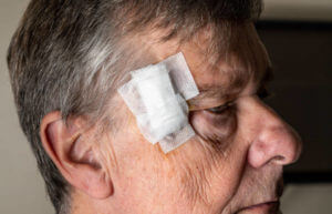 Senior adult male with dressings on surgery for removal of basal cell carcinoma caused by sun damage