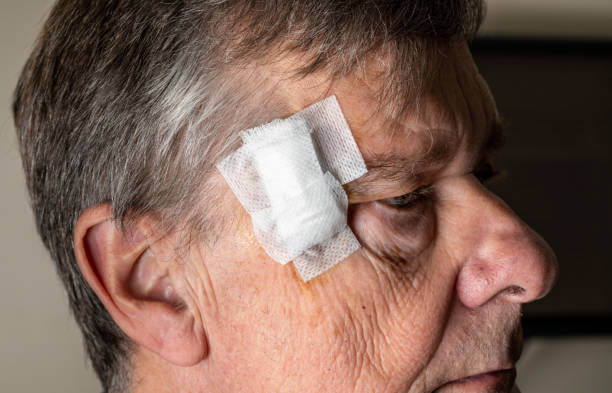 Senior adult male with dressings on surgery for removal of basal cell carcinoma caused by sun damage