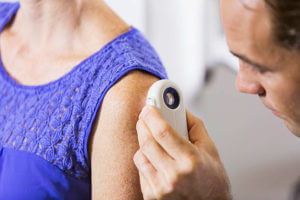 Cropped view of a male dermatologist carefully examining the skin of a female patient using a dermascope, looking for signs of skin cancer. Only the shoulder of the patient and the hand and part of the face of the doctor are visible.