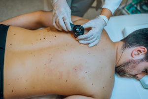 Dermatologist inspecting patient skin moles