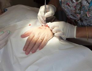 Making a Surgical Incision - Mohs Surgery Technique