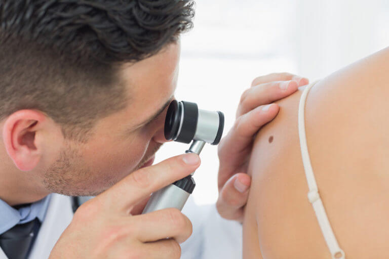 Basal Cell Carcinoma - TJ Giuffrida MD