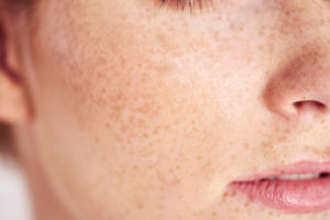 Mohs Surgery - Dermatology and Skin Cancer Center - Miami Florida