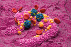 basal cell skin cancer