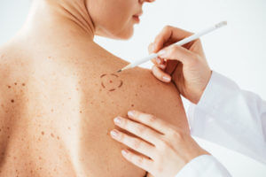 Skin cancer doctor near me: Find expert care for early detection and treatment.