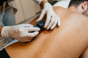 Basal cell carcinoma treatment: Find a qualified provider near you.