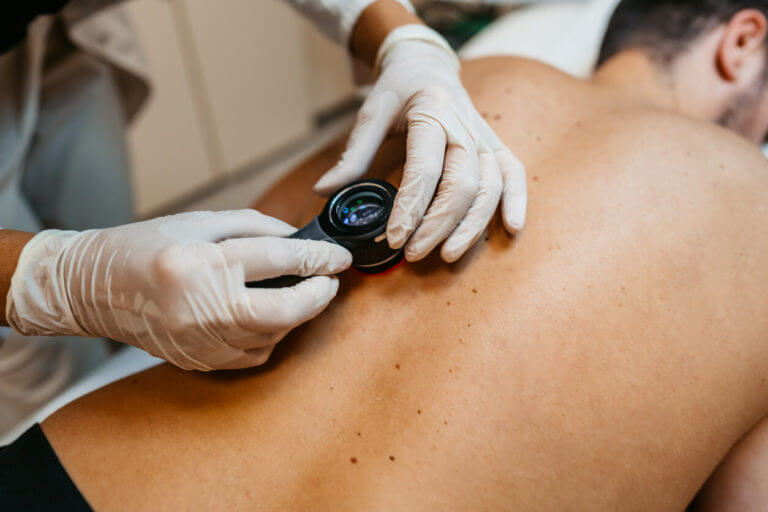 Basal cell carcinoma treatment: Find a qualified provider near you.