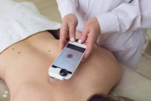 Female skin cancer doctor examining moles of a patient with magnifying glass