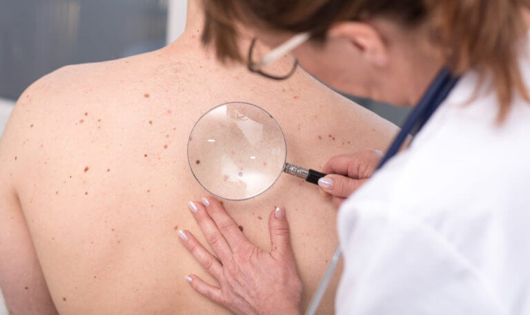 A female dermatologist examines a female patient's skin for melanoma diagnosis.
