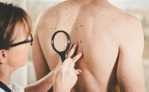Dermatologist examining the skin of a patient for signs of skin cancer.