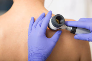 Dermatologist Inspecting patient skin moles at clinic