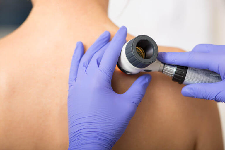 Dermatologist Inspecting patient skin moles at clinic